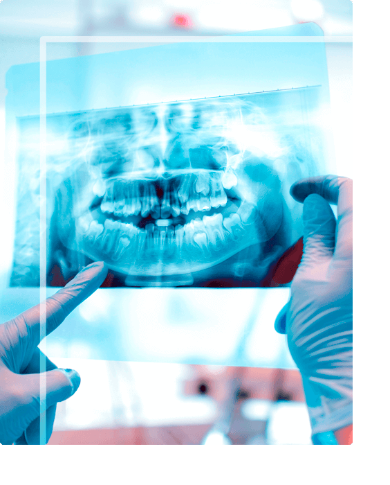 Cirurgia Oral em Belo Horizonte